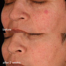 Load image into Gallery viewer, pro-collagen banking serum - Dermalogica Malaysia