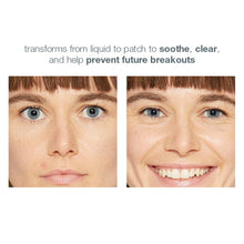 Load image into Gallery viewer, deep breakout invisible liquid patch - Dermalogica Malaysia